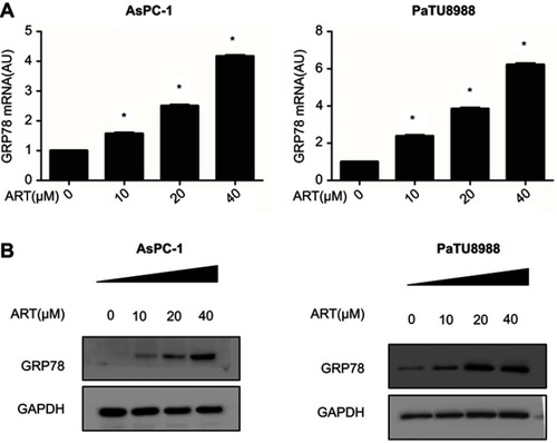 Figure 2 Expression level of GRP78 in artesunate treated KRAS mutant pancreatic cancer cells. (A) qRT-PCR analysis the mRNA expression level of GRP78 in AsPC-1 and PaTU8988 cancer cells after 24 hrs treated with various concentrations ART (0, 10, 20, and 40 µM). GAPDH was detected as a loading control. (B) Western blot analysis of protein expression levels of GRP78 in AsPC-1 and PaTU8988 cancer cells after 24 hrs treated with various concentrations ART (0, 10, 20, and 40 µM). GAPDH was detected as a loading control. ART represents for artesunate. Experiments were repeated three times, and the data are expressed as the mean±SEM. *P<0.05 relative to control, **P<0.01. Statistical analysis was performed using Student’s t-test.