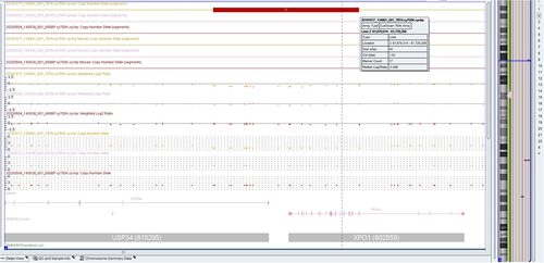 Figure 9 Patient’s chromosomal microarray results showing a deletion covering XPO1 and USP34 genes and no deletion in parents (Chromosome Analysis Suite (Chas) Software).