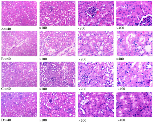 Figure 3 Renal histopathological results of different groups. (A–D) were the results of control group, HS(Tc) group, HS(Tc-1°C) group and HS(Tc+1°C) group, respectively.