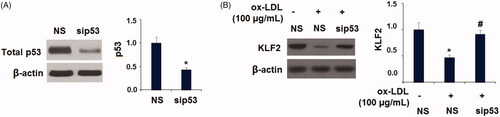 Figure 10. Silencing of p53 abolished the ox-LDL-induced reduction of KLF2 in HUVECs. Cells were transfected with p53 siRNA for 24 h, followed by stimulation with ox-LDL (100 µg/mL) for another 24 h; (A). The successful knockdown of p53; (B). Expression of KLF2 (*, p < .01 vs. vehicle group; #, p < .01 vs. ox-LDL treatment group).
