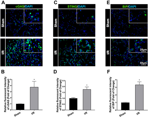 Figure 1 Immunofluorescent staining of cGAS, STING and BiP (ER stress marker protein) expression in lung tissue after IR in rats. (A) Immunofluorescent staining of cGAS expression in the lung tissue. (B) Immunofluorescent density analysis to quantify the expression of cGAS. (C) Immunofluorescent staining of STING. (D) Immunofluorescent density analysis to quantify the expression of STING. (E) Immunofluorescent staining of BiP. (F) Immunofluorescent density analysis to quantify the expression of BiP. Scale bar = 25μm or 50μm. Data are presented as mean ± SEM, n = 6 per group. *P < 0.05 vs sham group.