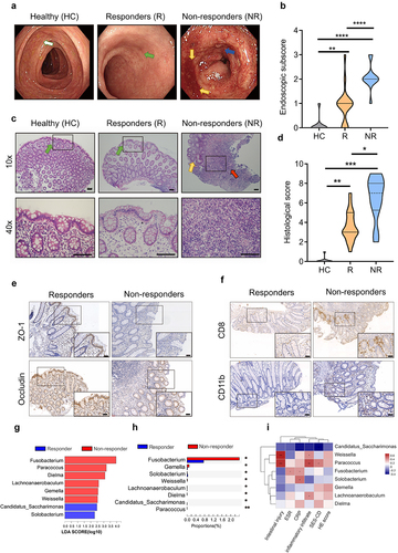 Figure 1. Gut dysbacteriosis is correlated with the compromised effects of anti-TNF-α therapy in IBD patients.