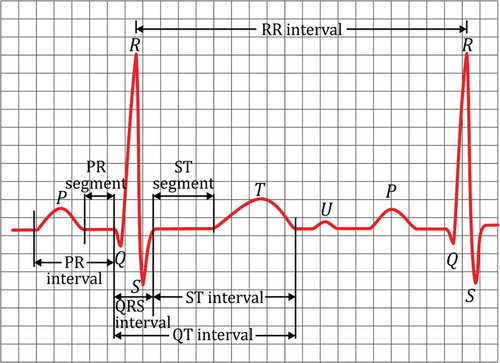 Figure 1. An example of an ECG signal with marked folds.