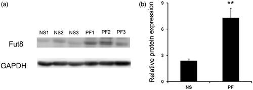 Figure 1. Fut8 expression was upregulated in the peritoneum of peritoneal fibrosis (PF) rats. PF rat model was established by daily intraperitoneal injection of standard peritoneal dialysis fluid for 6 weeks. (a and b) Representative Western blot images and analyses of Fut8 in normal saline (NS) and peritoneal fibrosis (PF) rats. Results are expressed as mean ± SEM of eight rats per group. **p < 0.01 vs. NS group.