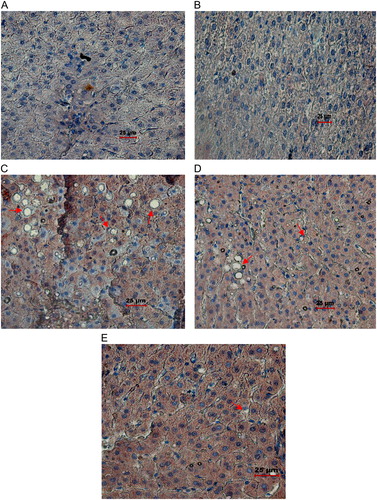 Figure 5. Histopathological#analysis of liver (magnification ×40). (A) Control liver tissue with normal hepatocyte architecture. (B) C+AA group liver tissue with normal hepatocyte architecture. (C) Ethanol group, showing altered hepatocyte architecture with vascular steatosis and inflammation. (D) Abstention group showing altered hepatocyte architecture with vascular steatosis and inflammation. (E) E+AA liver tissue showing nearly normal histological features with reduced amount of steatosis and inflammation.