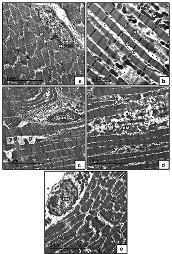 Figure 10. Transmission electron micrographs of skeletal muscle in 21-day-old rat. (a & b) control showed regularly arranged muscle fibers with normal distribution of A-band, I-band, Z-line & H-zone, normal nucleus with peripheral arrangement of heterochromatin, abundant mitochondria in between muscle fibers and glycogen granules. (c, d & e) high fat diet showing degenerated nucleus with clamped chromatin, fat droplets, degenerated muscle fibers, atrophied mitochondria. Abbreviation: A, dark band; G, glycogen granules; H, H-zone; I, light band; M, mitochondria; N, nucleus; Ne, nuclear envelope; Z, Z-line; asterisk*, degenerated muscle fibers; AM, atrophied mitochondria; F, fat droplets; DN, degenerated nucleus.