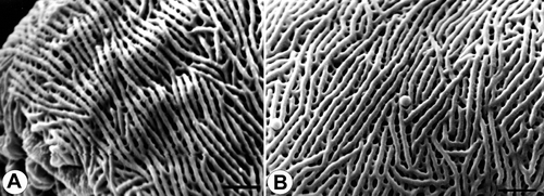Figure 8. Pollen grains of Veronica subg. Triangulicapsula (Subsect. Digitatae): A. V. chamaepithyoides, striato-reticulate surface structure near apocolopium (SEM); B. V. grisebachi, striato-reticulate surface structure near apocolpium (SEM). Scale bars – 1 μm.
