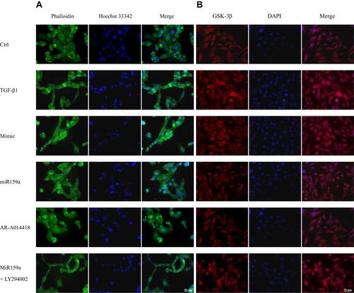 Figure 4 MiR159a inhibited TGF-β1-induced HSC differentiation and GSK-3β expression. (A) Representative fluorescence images showed differential actin filament expression pattern in HSCs, which were respectively treated with vehicle (negative mimic, 20 nM), miR159a (20 nM), GSK-3β inhibitor AR-A014418 (10 nM) or miR159a+GSK-3β agonist LY294002 (20+10 nM). The HSCs were stained for FITC-labeled phalloidin (green) to visualize F-actin and Hoechst 33342 (blue) to visualize nuclei. (B) Representative immunofluorescence showed differential GSK-3β expression in HSCs, which were respectively treated with vehicle (negative mimic, 20 nM), miR159a (20 nM), GSK-3β inhibitor AR-A014418 (10 nM) or miR159a+GSK-3β agonist LY294002 (20+10 nM). The HSCs were stained for texas red-labeled antibody (red) to visualize GSK-3β and DAPI (blue) to visualize nuclei. Scale bars, 50 μm.