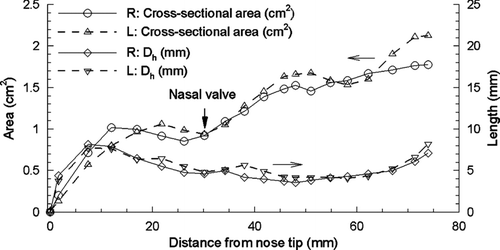 FIG. 2 Dimensions of the left and right nasal passages as a function of the distance from the nose tip based on coronal cross-sectional area and hydraulic diameter, Dh . The nasal value is marked with an arrow for the left and right passages.