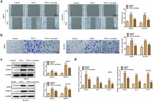 Figure 3. Effects of curcumin on cell migration, invasion, and inflammatory response in RA-FLS in vitro. (a) Wound scratch assay was used to detect cell migration. (b) Transwell assay was conducted to evaluate cell invasion. (c) Western blot analysis of MMP-2 and MMP-9 proteins in different groups. (d) Relative expression levels of inflammatory cytokines in different groups were determined by RT-qPCR analysis. **p < 0.01, ***p < 0.001 vs. control, #p < 0.05, ##p < 0.01, ###p < 0.001 vs. TNF-α.