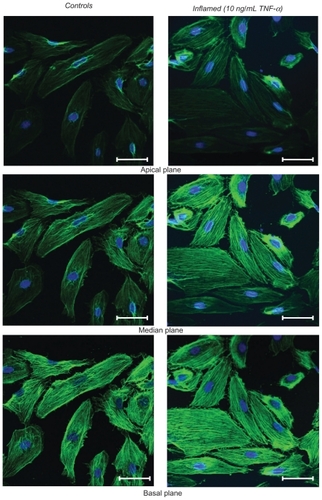 Figure S2b Actin staining for the HCAECs.