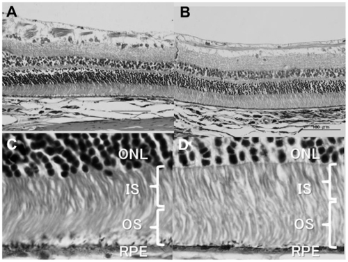 Figure 2 (A and B) The histopathology of the retina of two of four eyes after euthanasia. Even though artefacts due to the process of preparing specimens are observed, there are no obvious abnormalities in the retinal ganglion cell layer, inner plexiform layer, inner nuclear layer, outer plexiform layer, outer nuclear layer, or the photoreceptor inner and outer segments. (C and D) The magnified histology of the retina of two of four eyes after euthanasia corresponding to (A) and (B), respectively (magnification unknown). Photoreceptor inner (IS) and outer segments (OS) appear normal. The outer nuclear layer (ONL) looks normal.