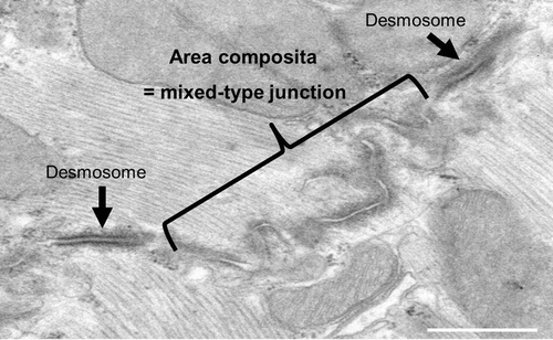 Figure 1. Transmission electron microscopy of a cross section through intercalated disc of a mouse heart. TEM image showing the intercalated disc with a large mixed-type junction (area composita) surrounded by two dense desmosome structures (black arrows).