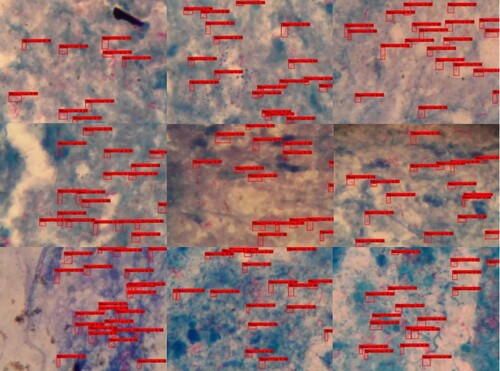 Figure 10. Results of our model test for selected Mycobacterium tuberculosis images.