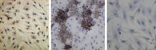 Figure 1.  The results of Col II specific staining (×200). A: Col II specific staining of induced cells; B: Col II specific staining of rat chondrocytes; C: Col II specific staining of rat BMSC.