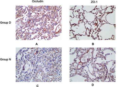 Figure 4 DEX increased expression of occludin and ZO-1 proteins in pulmonary epithelial barrier.