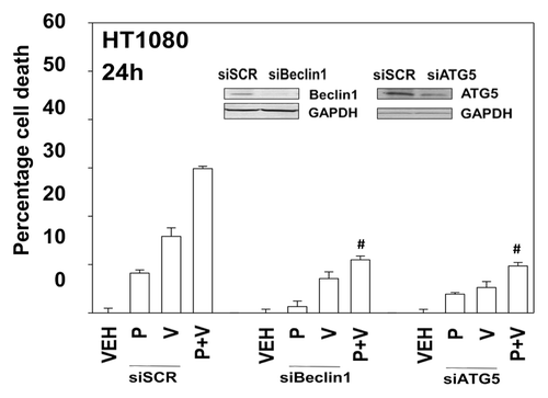 Figure 7. Knockdown of Beclin1 or ATG5 protects cells from pazopanib and valproate toxicity. HT1080 cells were transfected with scrambled control siRNA (siSCR) or siRNA molecules to knock down expression of Beclin1 (siB1) or ATG5 (siA5). Thirty-six hours after transfection cells were treated with vehicle (DMSO), pazopanib (P, 5.0 μM), and/or valproate (V, 500 μM). Cells were isolated 24 h after exposure and viability determined by trypan blue exclusion (n = 3, ± SEM). #P < less than corresponding value in siSCR cells.