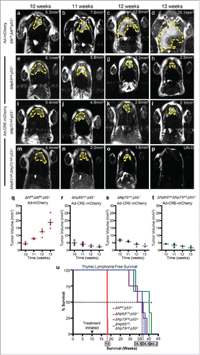 Figure 3. Combined deletion of ΔNp63 and ΔNp73 accelerated tumor regression in p53-deficient thymic lymphomas. Magnetic Resonance Imaging (MRI) of thymic lymphomas of mice of the indicated genotypes treated with Adenovirus (Ad)-mCherry (a-d) or Ad-Cre-mCherry (e-h, i-l and m-p). Age of mice is indicated across the top of each panel and the tumor volume is indicated (mm3) within each panel. UN-D indicates that the tumor was undetectable. The tumors are indicated by the dashed yellow line. Measurements of thymic lymphomas in mice of the indicated genotypes treated with Ad-mCherry (q) or Ad-Cre-mCherry (r-t), n = 3 to 5 mice per treatment followed over 8 weeks post infection. Kaplan Meier thymic lymphoma free survival curve of ΔNfl/fl;p53−/−, ΔNp63Δ/Δ;p53−/−, ΔNp73Δ/Δ;p53−/− orΔNp63Δ/Δ;ΔNp73Δ/Δ;p53−/− mice treated at 10 weeks with Ad-mCherry or Ad-Cre-mCherry to delete the ΔN isoforms of p63 and p73 (u), n = 3 – 5 mice, p<0.005. Boxed numbers on x-axis represent median time (weeks) of survival for the indicated genotypes.