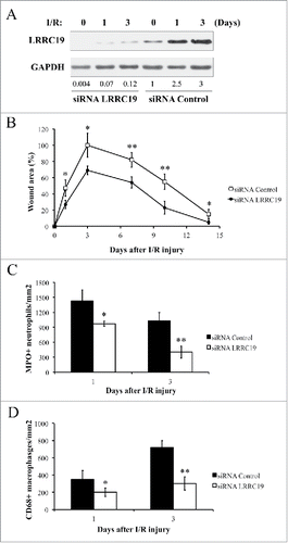 FIGURE 2. Knocking down LRRC19 reduces pressure ulcer formation and decreases the inflammatory cell infiltration in wound area. A) Western blot analysis of LRRC19 protein expression at the wound site during I/R injury. The wound area was topically applied with 100 pmol of either LRRC19 siRNA or control siRNA immediately after 1st ischemia delivery, followed by day 0, 1, 3, 6, 9, 12 after I/R injury induced. The end of 2nd ischemia was assigned day 0. The data are representative of n = 4 subjects for each group. The band intensity of LRCC19 was normalized against GAPDH. The normalized band densitometry of the siRNA control treated sample at day 0 was set as baseline of value 1. B) The average size of the wound area in mice (n = 6 for each group) treated with either LRRC19 or control siRNA during I/R injury were measured at day 0, 1, 3, 7 10 and 14 post injury. The end of 2nd ischemia was assigned day 0. The size of the ulcer in control group on day 3 after I/R was assigned a value of 100%. Immunohisochemistry was used to study the number of C) neutrophils (myeloperoxidase positive) and D) macrophages (CD68 positive) at the lesion site. Values were determined in six random microscopic fields (∼20,000 mm2) in n = 6 mice per group. The results are presented as cells per mm2. The data are presented as the mean ± SD (n = 4 for each time point). *p < 0.05, **p < 0.01, significantly different from control group.