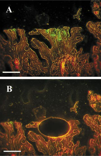 Figure 1. In situ visualization of a Brachyspira sp. in a colonic biopsy specimen.The bacteria were targeted with a green fluorescent 16S ribosomal RNA (rRNA)-targeting oligonucleotide probe, while the intestinal cell material exhibited red autofluorescence. Scale bar, 250 µm. (A) Before microdissection. (B) After microdissection.