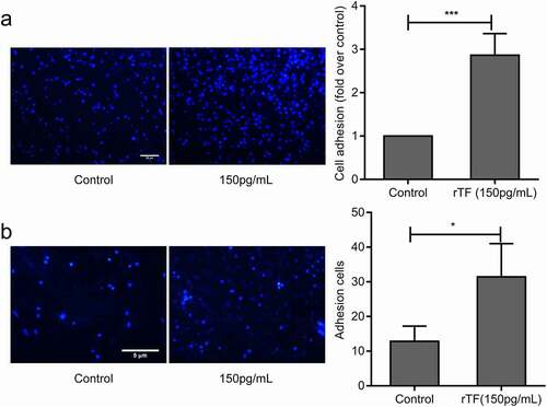 Figure 3. Effect of Exogenous TF on adhesion of HS-578 T to HUVECs.(a) HS-578 T pretreated with 150pg/mLrTF, the adhesion of cells to HUVECs were examined by static adhesion assay,bar = 20 μm, the bar graph on the right represents the adhesion rate (n = 6, **P < 0.01 vs. untreated cells).(b) The adhesion of HS-578 T cells(5 × 105cells/mL) pretreated with 150 pg/mL rTF to endothelium under shear (2dyns/cm2)were examined by Parallel plate flow assay, bar = 5 μm, the number of adhesion cells was quantified by Image J (right,n ≥ 5, *P < 0.05 vs. untreated cells)