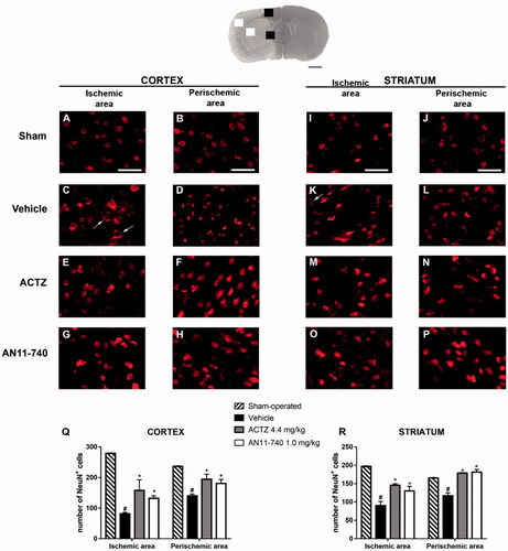 Figure 6. Effect of sub-chronic treatment with ACTZ and AN11-740 on neuronal damage in cortex and striatum 24 h after pMCAo. Upper part: Representative photomicrograph of a coronal section (at Bregma = 0,Citation37) showing the ischaemic area in a vehicle-treated rat. The two white and black squares indicate regions within the ischaemic area and within the perischemic area, respectively, where photomicrographs were captured. Scale bar = 2 mm. (A–P) Representative microphotographs of neurons (red) in cortical ischaemic and perischemic areas and in striatal ischaemic and perischemic areas of sham-operated (A, B; I, J; n = 3), vehicle- (C, D; K, L; n = 4) ACTZ- (E, F; M, N; n = 4) and AN11-740- (G, H; O, P; n = 5) treated rats. Scale bar = 50 µm. (Q, R) Quantitative analysis of NeuN+ cells in cortical and striatal ischaemic and perischemic areas, bar graphs represent mean ± SEM of the number of neurons per optical field (20×). One-way ANOVA followed by Newman–Keuls post hoc test: #at least p < 0.01 vehicle-treated vs. sham-operated rats; *at least p < 0.05 ACTZ- and AN11-740- vs. vehicle-treated rats.