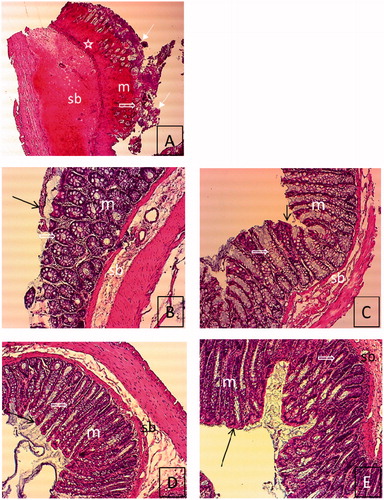 Figure 5. Histological features of rat colon sections in different groups. (A) Tissue image of group 0. (B) Tissue image of group 1, (C) Tissue image of group 2, (D) Tissue image of group 3, (E) Tissue image of group 4. Degeneration of epithelium and intestinal crypt, severe inflammatory cell infiltration, mucosal and submucosal edema in group 0 (A) (H&E. 4 × 10). Improvement in the structure of the intestinal crypt, incompleted epitelization, no edema in mucosa and submucosa in group 1 (B) (H&E. 10 × 10). Regular epithelium, improvement of the structure of the intestinal crypt, and no edema in mucosa and submucosa in Groups 2–4 (C–E) (H&E. 10 × 10). Epithelium (Display full size), intestinal crypt (Display full size), inflammatory cell infiltration (Display full size), mucosa (m) and submucosa (sb).
