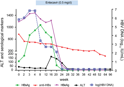 Figure 1 The dynamic changes in serological markers, HBV DNA and ALT during infection by the HBV G145R immune escape mutant. Entecavir treatment was started during the 4th week. HBsAg became undetectable, and HBeAg/anti-HBe seroconversion was achieved during the 36th week, and then entecavir was withdrawn. aminotransferase, ALT; hepatitis B surface antigen, HBsAg; hepatitis B virus, HBV.