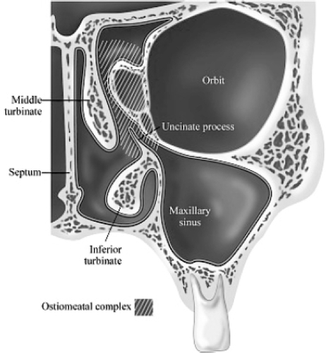 Figure 3 Anatomy of the osteomeatal complex.