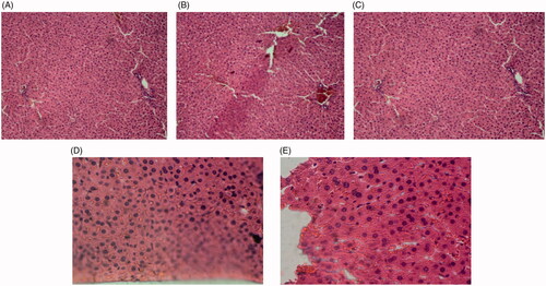 Image 1. Liver tissue sections of control rats (A), diabetic rats (B), diabetic rats treated with 75 mg/kg of S. bachtiarica extract (C), diabetic rats treated with 150 mg/kg of S. bachtiarica extract (D) and diabetic rats treated with 250 mg/kg of S. bachtiarica extract (E); haematoxylin-eosin staining; magnification x40.