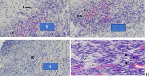 Figure 9 Photograph of histological section on burn wound tissues treated by crude extract.