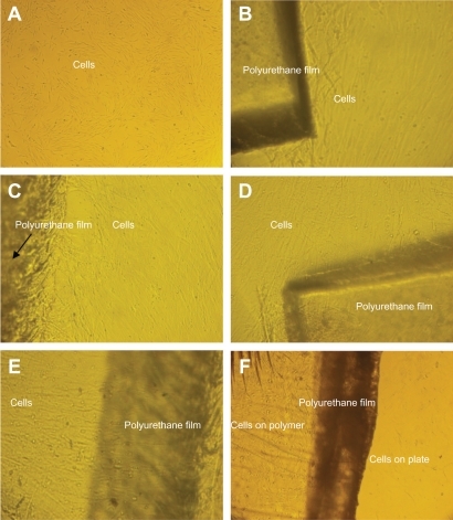 Figure 6 Unrestricted somatic stem cell culture on the (A) control (TCPS) surface, (B) normal polyurethane (PU), (C) PU modified by argon plasma (30 seconds), (D) PU modified by argon plasma (60 seconds), (E) PU modified by oxygen plasma (30 seconds), and (F) PU modified by oxygen plasma (60 seconds).