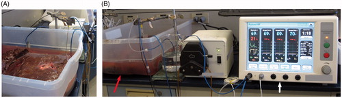 Figure 2. Ex-vivo experimental setup. (A) Generator (white arrow) and plastic basin containing saline solution and liver (red arrow). (B) The liver was partially submerged in the saline bath, with a stand holding the electrode in place.