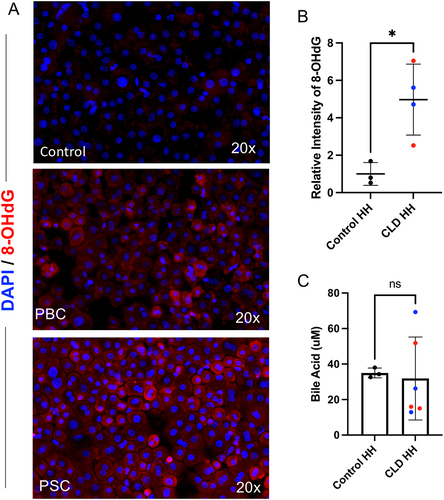 Figure 3. Oxidative stress and bile acid assay in primary human hepatocytes. (a) Immunofluorescence staining of fixed hepatocytes from a control liver and livers with PBC, showing 8-OHdG in red and cell nuclei in blue. (b) The relative intensity of these immunostainings is quantified in graph format with CLD HH samples (n = 4), including PBC (blue) and PSC (red), and Control HH samples (n = 3). (c) Bile Acid assay results are shown, with the CLD HH samples including PBC (blue) and PSC (red).