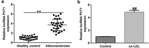Figure 1. Expression of PVT1 in serum samples and HUVECs treated with ox-LDL by qRT-PCR. (a) High expression of PVT1 in serum samples. (b) Significantly high expression of PVT1 in HUVECs. **P < 0.01 vs. Healthy control; ##P < 0.01 vs. Control.