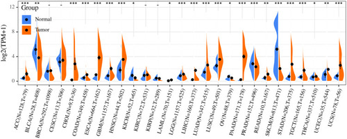 Figure 2 Analysis of differential expression of Dkk1 in tumor tissues and normal tissues based on TCGA and GTEx database.