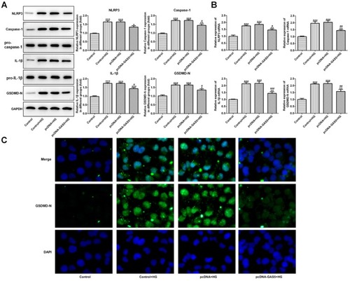 Figure 3 GAS5 overexpression reduced the pyroptosis of HG-induced HK-2 cells. (A) HG induction upregulated the protein expression of NLRP3, cleaved-caspase1, IL-1β and GSDMD-N which decreased the GAS5 overexpression. *P<0.05, **P<0.01 and ***P<0.001 vs control group. #P<0.05 vs control+HG group. (B) HG induction upregulated the mRNA expression of NLRP3, cleaved-caspase1, IL-1β and GSDMD-N which decreased theGAS5 overexpression. **P<0.01 and ***P<0.001 vs control group. #P<0.05, ##P<0.01 and ###P<0.001 vs control+HG group. (C) The expression of GSDMD-N was determined by the images of immunofluorescence.