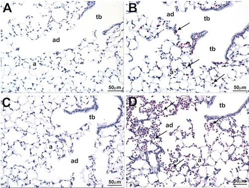 Figure 3.  Effect of CBD on LPS-induced acute pulmonary centriacinar inflammation. Mice were treated as outlined in the legend for Figure 2. Left lung lobes (6 h post-LPS) were fixed and sections were stained with NIMP-R14 anti-neutrophil antibody and counter-stained with hematoxylin. (A) Sal/Oil; (B) LPS/Oil; (C) Sal/CBD; (D) LPS/CBD. Arrows depict positive staining for neutrophils in the centriacinar region of the lung. a, alveoli; ad, alveolar duct; tb, terminal bronchiole. Neutrophilic inflammation is present in (B) and (D), with enhanced neutrophilic influx in the proximal alveolar ducts and associated alveoli in D compared to B.