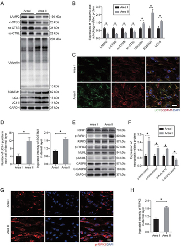 Figure 1. Lysosomal dysfunction was associated with necroptosis in ischemic flaps. (A) LAMP2, c-CTSD (cleaved CTSD), sc-CTSB (single-chain CTSB), sc-CTSL (single-chain CTSL), UB, SQSTM1 and LC3 protein levels in the skin from area I and area II on postoperative day 7. (B) Quantification of the expression levels of lysosome- and autophagy-related proteins in the skin from both areas. Data are expressed as the means ± SEM (n = 6). (C) Immunofluorescence staining of LC3-II and SQSTM1 in the skin from area I and area II on postoperative day 7. Scale bars: 10 μm. (D) Comparison of the number of LC3-II puncta in each cell of the dermal layer between area I and area II; comparison of the integrated intensity of SQSTM1 in the dermal layer between area I and area II. Data are expressed as the means ± SEM (n = 6). (E) RIPK1, p-RIPK1, RIPK3, p-RIPK3, MLKL, p-MLKL, CASP8 and c-CASP8 protein levels in the skin from area I and area II on postoperative day 7. (F) Quantification of the expression levels of necroptosis-related proteins in the skin from both areas. Data are expressed as the means ± SEM (n = 6). (G) Immunofluorescence staining to detect p-RIPK3 in the skin from both areas on postoperative day 7. Scale bars: 10 μm. (H) Comparison of the integrated intensity of p-RIPK3 in the dermal layer between both areas. Data are expressed as the means ± SEM (n = 6). Significance: *p < 0.05.