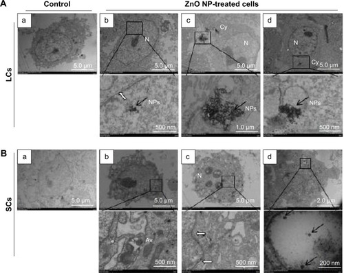 Figure 4 TEM observations of ZnO NP internalization by LCs and SCs.Notes: (A) (a) Untreated LCs, (b–d) localization of ZnO NPs within the Cy and N of the LCs; bottom row = magnifications of the framed region. (B) (a) Untreated SCs, (b–d) localization of ZnO NPs within the SCs; bottom row = magnifications of the framed region. Black arrows indicate ZnO NPs and white arrows indicate the intramembranous space between the inner and outer membranes of the nuclear envelope.Abbreviations: Av, autophagic vacuoles; Cy, cytoplasm; LCs, Leydig cells; N, nucleus; NPs, nanoparticles; SCs, Sertoli cells; TEM, transmission electron microscopy.
