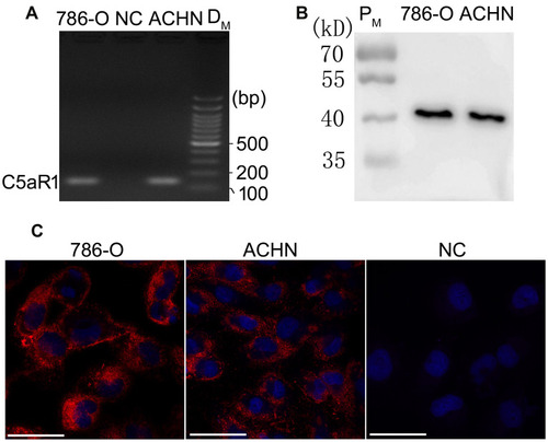 Figure 1 C5aR1 was expressed in both 786-O and ACHN cells. The expression of C5aR1 in 786-O and ACHN cells was examined by RT-PCR (A), Western blotting (B) and immunofluorescence analysis (C). Scale bar, 100µm.