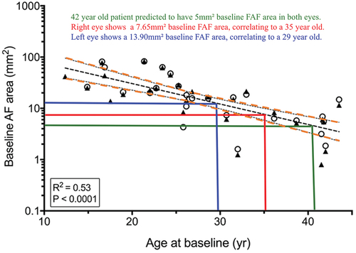 Figure 2. Adapted figure from an article by Aylward et al. (Citation17) showing a correlation between residual FAF area (mm2, shown on a log scale) and age in a cohort of 56 eyes (28 patients) for the right (hollow circles) and left (solid triangles) eyes. The green line illustrates that the patient, as a 42-year-old, is an outlier in terms of baseline FAF area for his age, within the orange 95% confidence interval lines.