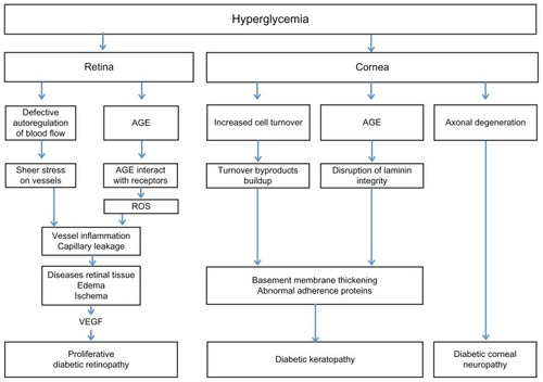 Figure 1 Pathophysiology of ocular complications of diabetes.