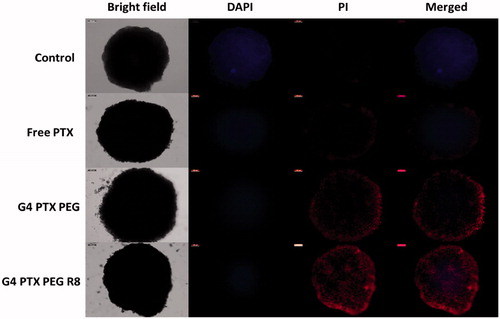Figure 10. Live/dead cell micrographs of tumor spheroids captured using fluorescence microscope at 10× magnification.