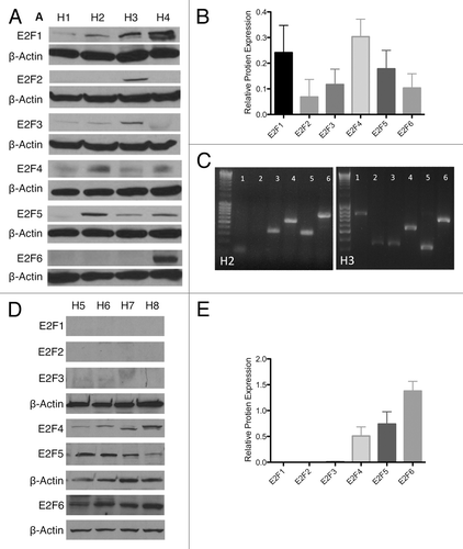 Figure 1. Endogenous E2F expression. (A and B) Western blot and semi-quantification of protein isolated from whole islets of 4 human islet isolations (H1–H4) showing E2F 1–6 expression. (C) Reverse transcription PCR for E2F 1–6 in H2 and H3, showing variability of protein expression partially correlates with mRNA expression. (D and E) Western blot and semi-quantification of protein isolated from the nuclear fraction of islets of 4 human islet isolations (H5–H8) showing E2F 1–6 expression.