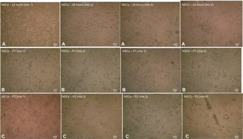 Figure 11 Neural stem cells induction after 24 hours exposure to BME using four different culturing media formula.