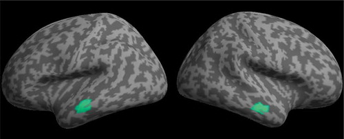 Figure 5. MSP localization of the main effect of time at 250 ms rendered onto a flattened image of the cortical surface (voxelwise thresholded at p < .001 RFT FWEC).