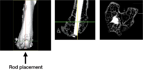 Figure 1. Microcomputed tomographic images of: (A) a mouse femur with no implanted rod. The arrow indicates the orientation of rod placement. (B) A 25-gauge rod inserted retrograde in a line-to-line fit in the distal femur. (C) Cross-section taken at the level of the distal femoral metaphysis showing the location of histological analysis.