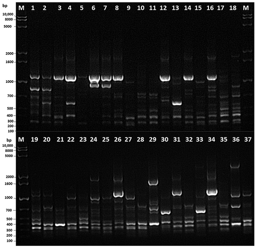 Figure 1 Representative gel electrophoresis of ERIC-PCR using ERIC2 primer. Lane 1: molecular mass ladder and lanes 2 to 20: isolates of typical and atypical EPEC from humans in the Eastern Province of Saudi Arabia.