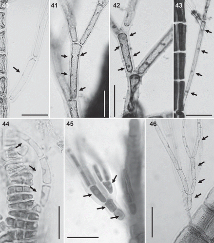 Figs 40–46. Trichoblast nuclei (arrows) in the Polysiphonieae. Uninucleate trichoblast cells in Polysiphonia scopulorum (Fig. 40, Polysiphonia sensu stricto clade 1), P. denudata (Fig. 44, Carradoriella clade), P. schneideri (Fig. 45, ‘P.’ schneideri clade) and P. blandii (Fig. 46, Melanothamnus clade). Multinucleate trichoblast cells in species of the Vertebrata clade: P. nigra (Fig. 41), Boergeseniella fruticulosa (Fig. 42) and P. foetidissima (Fig. 43). Scale bars: Figs 40–43, 60 µm, Fig. 44, 30 µm; Fig. 45, 20 µm; Fig. 46, 100 µm.